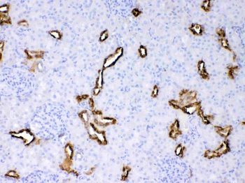 Cytokeratin 18/KRT18 Rabbit Polyclonal Antibody