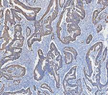 Cytokeratin 18/KRT18 Rabbit Polyclonal Antibody