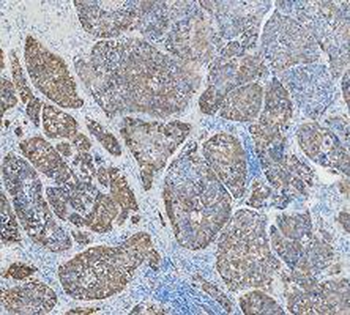 Cytokeratin 18/KRT18 Rabbit Polyclonal Antibody