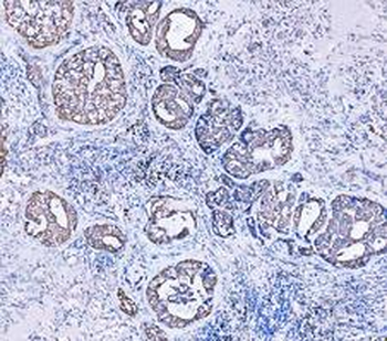 Cytokeratin 18/KRT18 Rabbit Polyclonal Antibody
