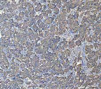 Cytokeratin 18/KRT18 Rabbit Polyclonal Antibody