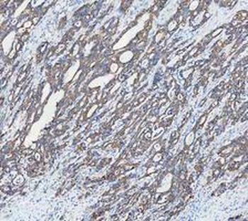 Cytokeratin 18/KRT18 Rabbit Polyclonal Antibody