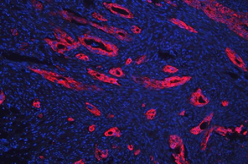 Cytokeratin 18/KRT18 Rabbit Polyclonal Antibody