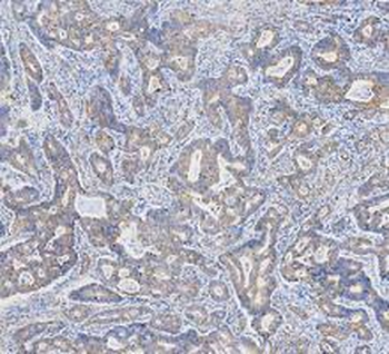 Cytokeratin 18/KRT18 Rabbit Polyclonal Antibody