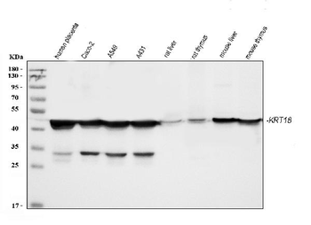 Cytokeratin 18/KRT18 Rabbit Polyclonal Antibody