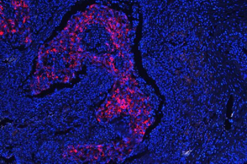 Cytokeratin 18/KRT18 Rabbit Polyclonal Antibody