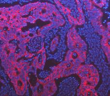 Cytokeratin 18/KRT18 Rabbit Polyclonal Antibody