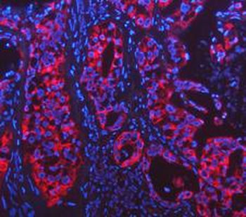 Cytokeratin 18/KRT18 Rabbit Polyclonal Antibody