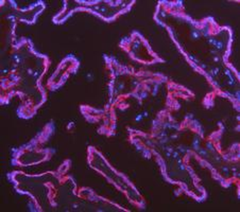 Cytokeratin 18/KRT18 Rabbit Polyclonal Antibody