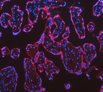 Cytokeratin 18/KRT18 Rabbit Polyclonal Antibody