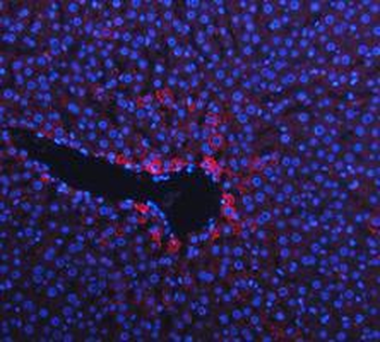 Cytokeratin 18/KRT18 Rabbit Polyclonal Antibody