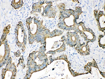 Cytokeratin 18/KRT18 Rabbit Polyclonal Antibody