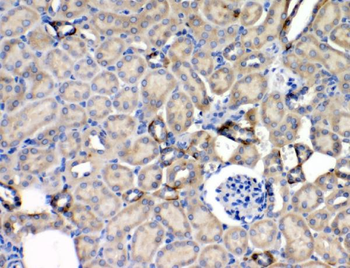 Leptin Receptor/LEPR Rabbit Polyclonal Antibody