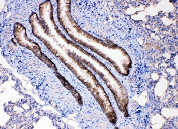 Leptin Receptor/LEPR Rabbit Polyclonal Antibody