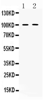 PDE5A Rabbit Polyclonal Antibody