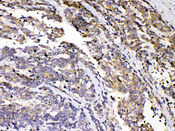 Protein Kinase A regulatory subunit I alpha/PRKAR1A Rabbit Polyclonal Antibody