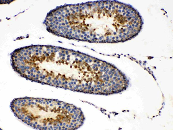 Protein Kinase A regulatory subunit I alpha/PRKAR1A Rabbit Polyclonal Antibody