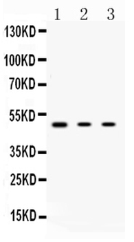 Protein Kinase A regulatory subunit I alpha/PRKAR1A Rabbit Polyclonal Antibody