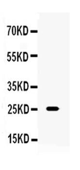 TNF alpha Rabbit Polyclonal Antibody