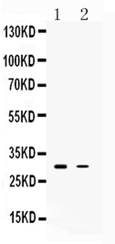 TSG6/TNFAIP6 Rabbit Polyclonal Antibody