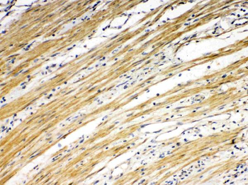DR5/TNFRSF10B Rabbit Polyclonal Antibody