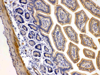 DR5/TNFRSF10B Rabbit Polyclonal Antibody