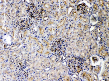 DR5/TNFRSF10B Rabbit Polyclonal Antibody