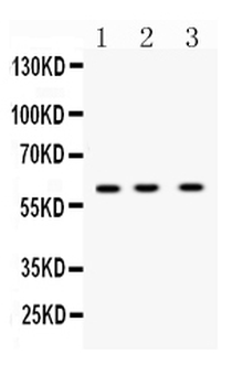 DR5/TNFRSF10B Rabbit Polyclonal Antibody