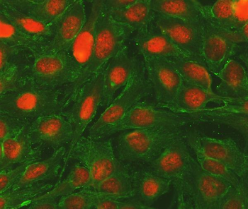 Bcl-2/BCL2 Rabbit Polyclonal Antibody