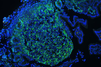 CD44 Rabbit Polyclonal Antibody