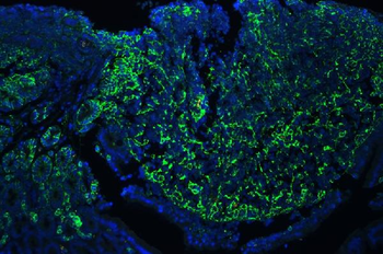 CD44 Rabbit Polyclonal Antibody