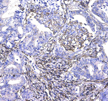 CD44 Rabbit Polyclonal Antibody