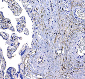 CD44 Rabbit Polyclonal Antibody