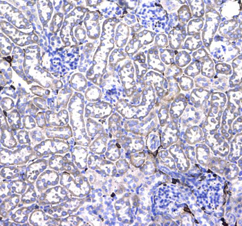 CD44 Rabbit Polyclonal Antibody