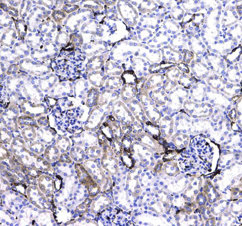CD44 Rabbit Polyclonal Antibody