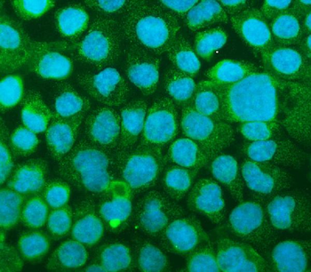 ICAM1 Rabbit Polyclonal Antibody