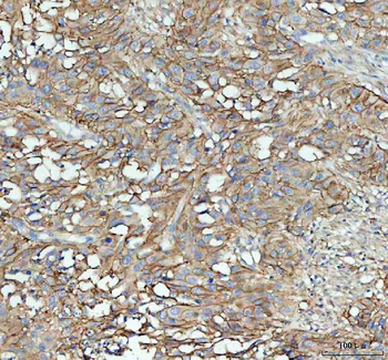 ICAM1 Rabbit Polyclonal Antibody