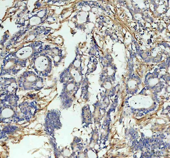 ICAM1 Rabbit Polyclonal Antibody