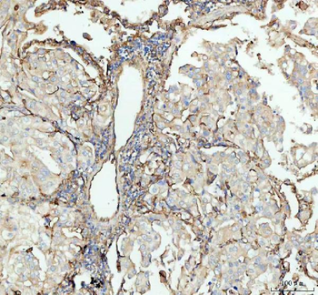 ICAM1 Rabbit Polyclonal Antibody