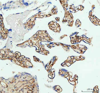ICAM1 Rabbit Polyclonal Antibody
