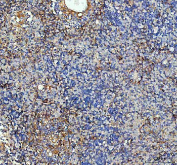 ICAM1 Rabbit Polyclonal Antibody