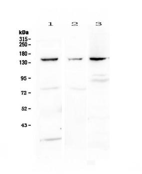VEGF Receptor 1/FLT1 Rabbit Polyclonal Antibody