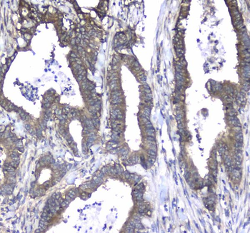 L1CAM Rabbit Polyclonal Antibody