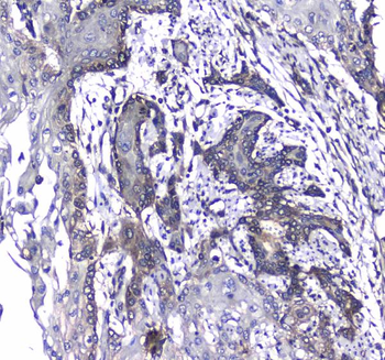 L1CAM Rabbit Polyclonal Antibody