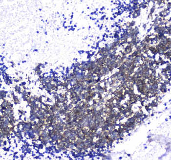 L1CAM Rabbit Polyclonal Antibody