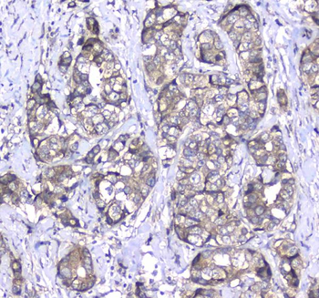 L1CAM Rabbit Polyclonal Antibody