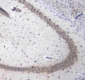 L1CAM Rabbit Polyclonal Antibody