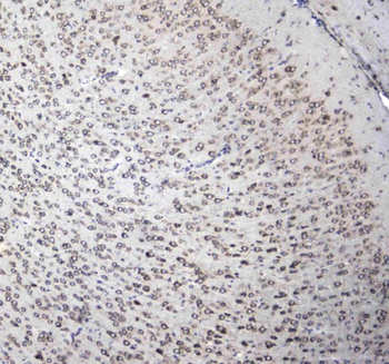 L1CAM Rabbit Polyclonal Antibody