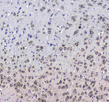 L1CAM Rabbit Polyclonal Antibody