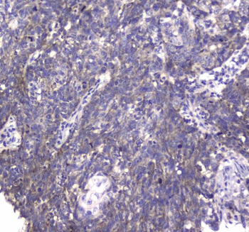 MRE11/MRE11 Rabbit Polyclonal Antibody